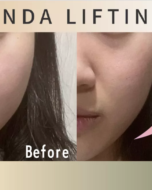 小臉保養體驗（Onda Lift + LDM）