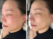 【Facial Contouring & Herbal Peeling Specialty Salon】IROHA 1