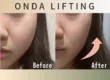 【小顔・ハーブピーリング専門店】IROHA 3