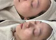 【Facial Contouring & Herbal Peeling Specialty Salon】IROHA 5