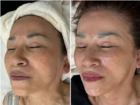 【Facial Contouring & Herbal Peeling Specialty Salon】IROHA 6